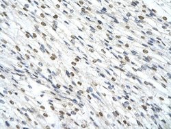 SMARCD2 Rabbit anti-Human, Polyclonal, Novus Biologicals:Antibodies:Primary